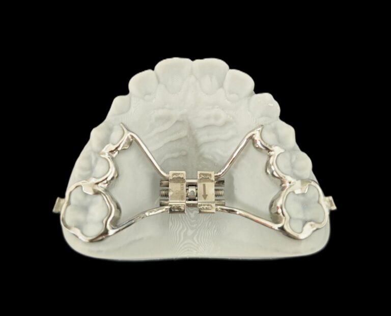 OrthoRetainer Dentallabor