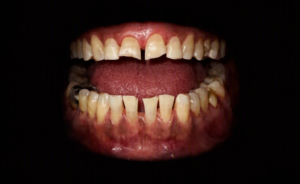 Excellence Dentallabor Kabai