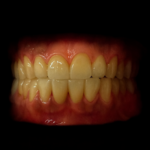 Excellence Dentallabor Kabai